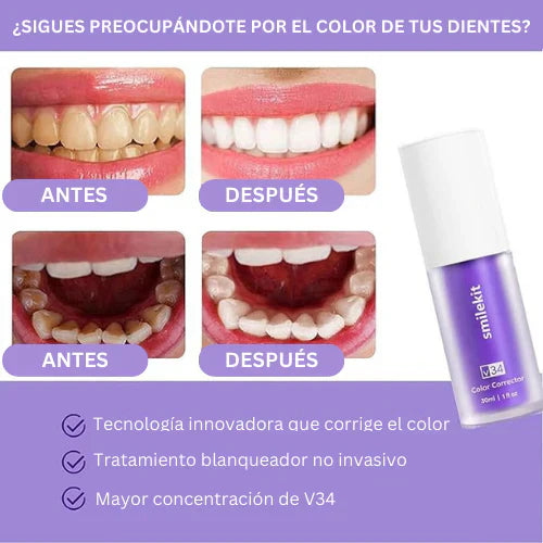 Regala un Cepillo Dental al Comprar el Blanqueador Sonrisa de Ensueño – La Combinación Perfecta para una Sonrisa Perfecta